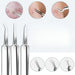 15pcs Stainless Steel Blackhead Remover Pimple Popper Tools