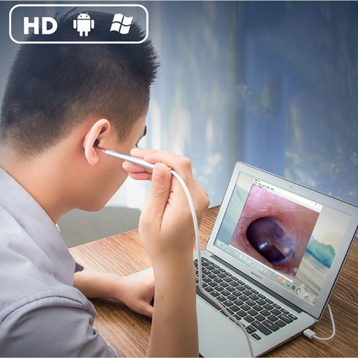 1Mp Hd Visual Ear Nose Tooth Endoscope Borescope With 6 Leds Lens Diameter 5.5Mm