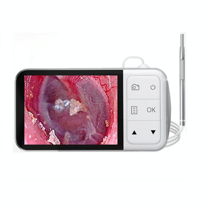 C02 Visible Ear Spoon With 4.5 Inch Sreen