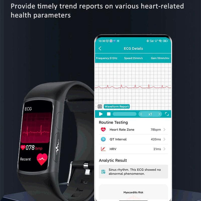 Tft Hd Smart Bracelet Bluetooth Calling Blood Oxygen Monitoring