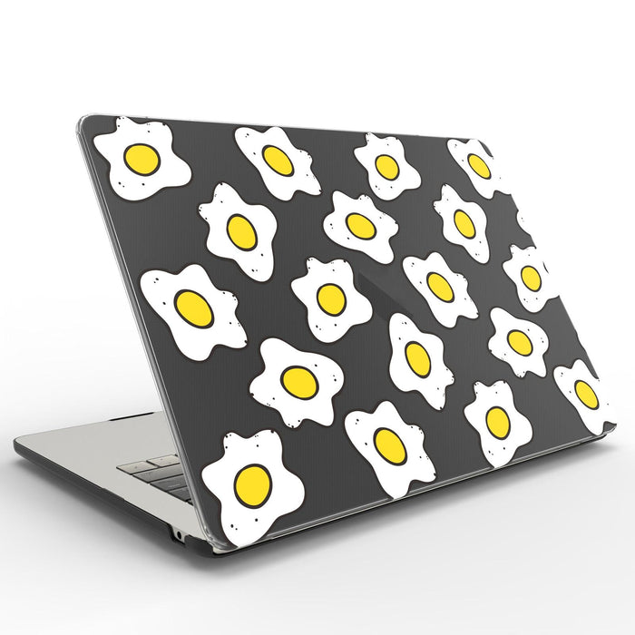 Uv Printed Pattern Laptop Frosted Protective Case
