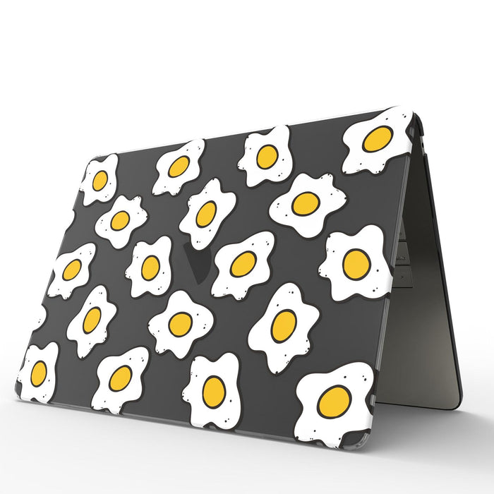 Uv Printed Pattern Laptop Frosted Protective Case