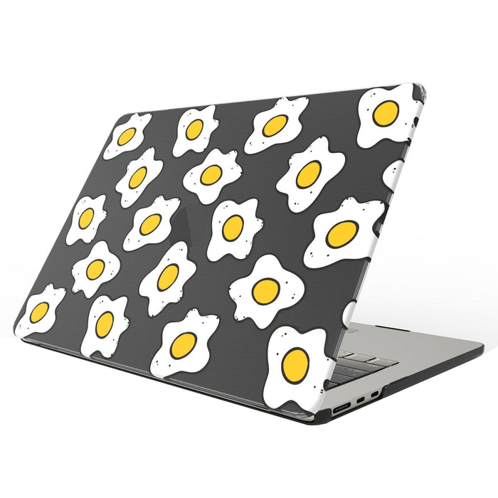 Uv Printed Pattern Laptop Frosted Protective Case