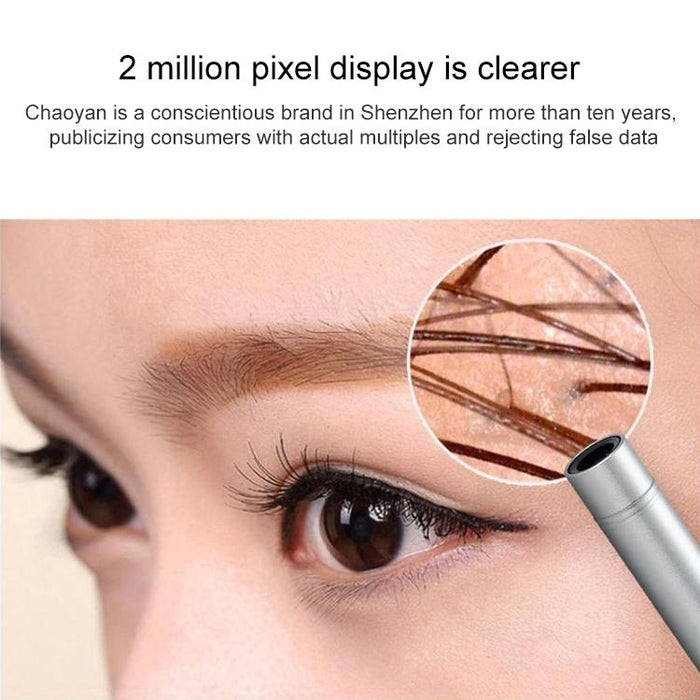 Supereyes B003 + Digital Electronic Vaginal Cervical Endoscope Private Inspection Instrument Self-Inspection Mirror