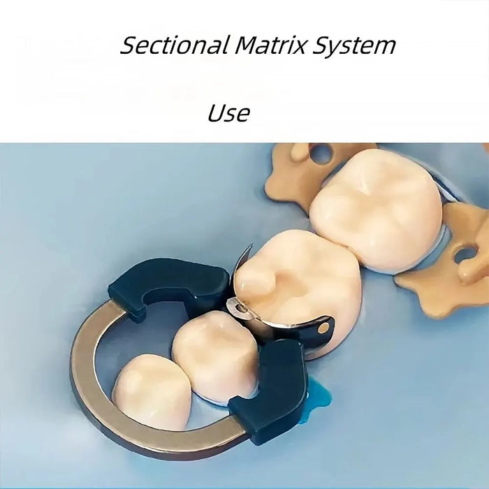 Contoured Matrix System For Dentists