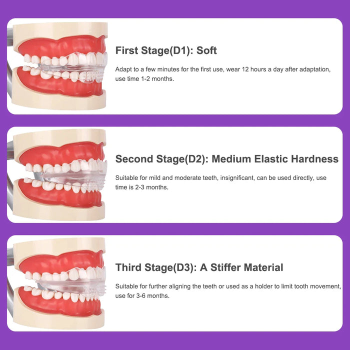 Adult Dental Braces Trainer For Teeth Alignment