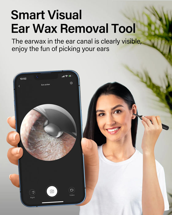 Bebird X0 Ear Cleaner - Smart Visual Tool With Otoscope, 1080P Hd Endoscope, And Earpick For Ear Wax Removal