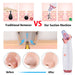 Electric Blackhead Remover Vacuum