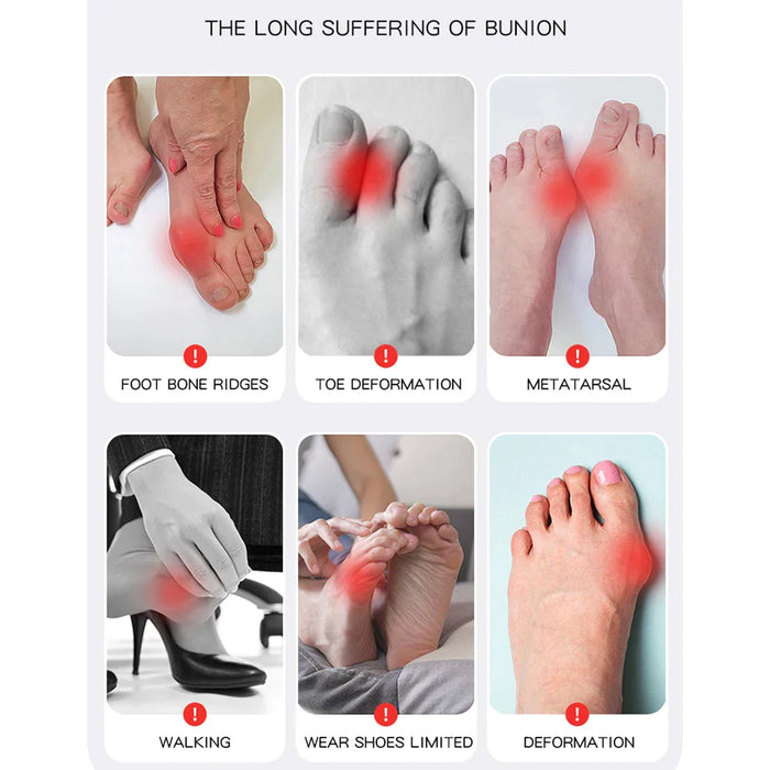 1 Pc Separator Toe Straightener Bunion Corrector Relief For Women And Men