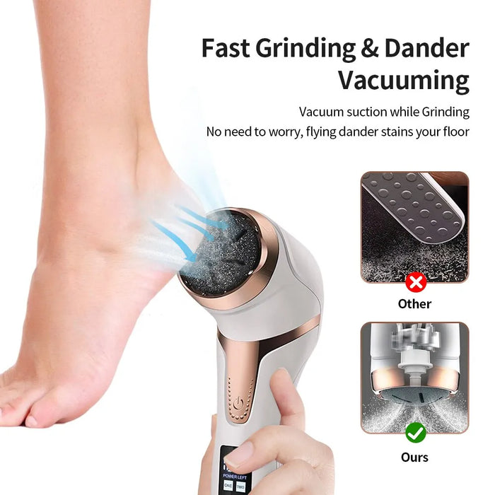 Portable Electric Foot Callus Remover