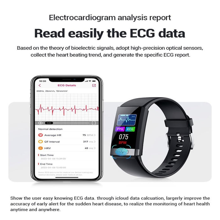 Colour Smart Watch Heart/Bp/Oxygen/Glucose Monitoring