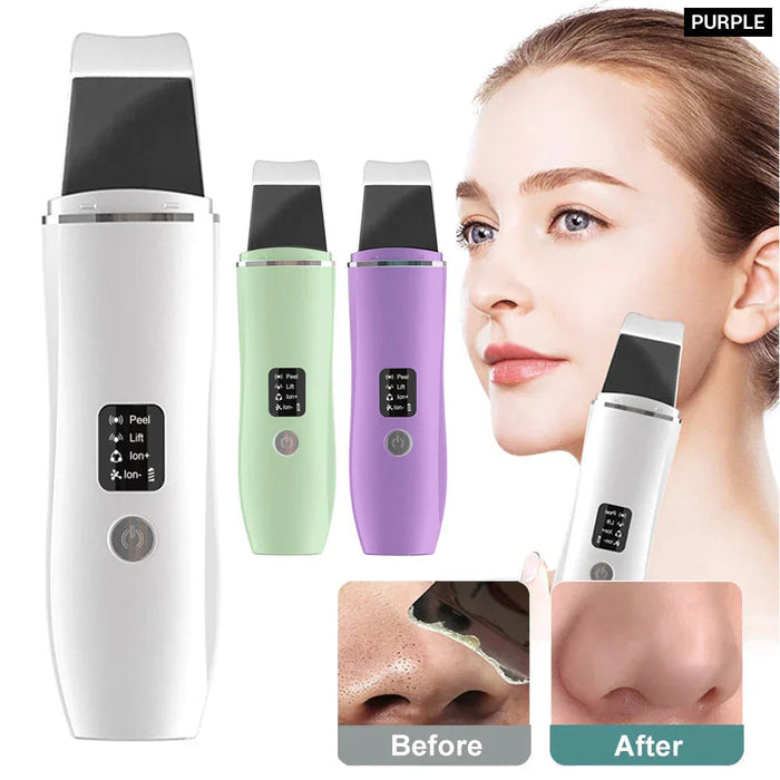 Deep Clean Ultrasonic Skin Scrubber For Face