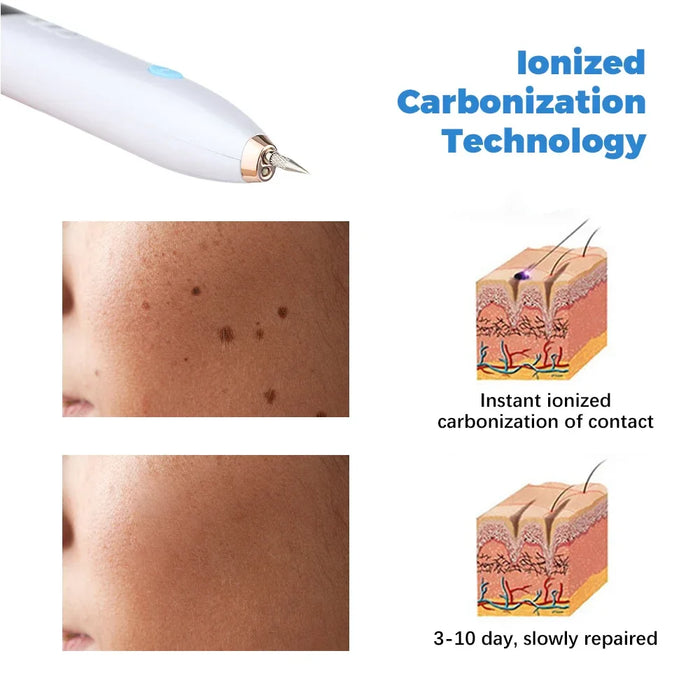 9 Mode Lcd Mole Removal Pen For Tattoo Freckle Dark Spot