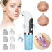 Usb Rechargeable Blackhead Vacuum For Clear Skin