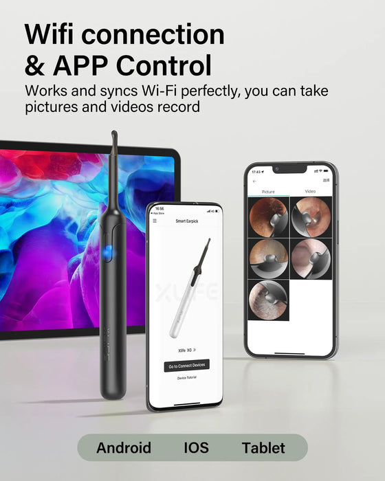 Bebird X0 Ear Cleaner - Smart Visual Tool With Otoscope, 1080P Hd Endoscope, And Earpick For Ear Wax Removal