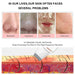 Ultrasonic Skin Scrubber Vibration Blackhead Remover Facial